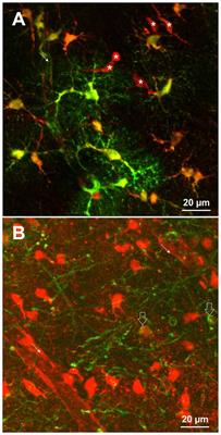 Limitations of Sulforhodamine 101 for Brain Imaging